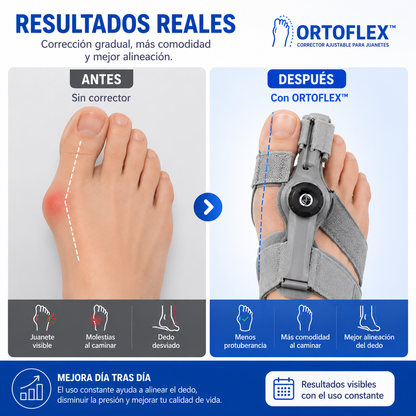 OrtoFlex™ | Corrector Ajustable para Juanetes 180°