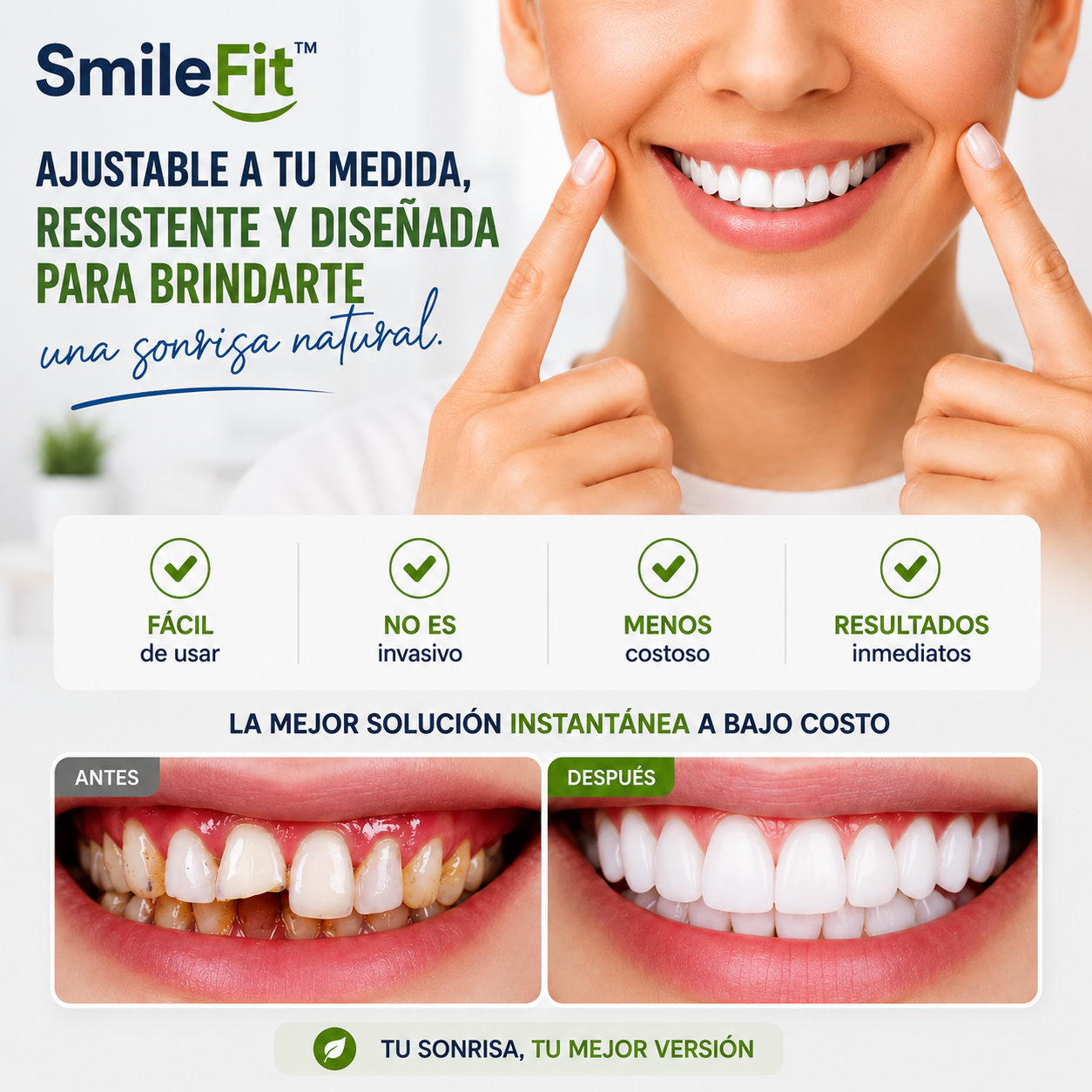 SmileFit™ CARILLAS DENTALES REMOVIBLES